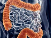 Colorectal Cancer Risk From Obesity Varies by Sex Colon Cancer Diagnosed Earlier Under Medicaid Expansion