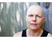 Risk for Developing, Dying From Second Cancer Higher for Survivors B 1/5 -- Type of Mouth Bacteria May Raise Lung Cancer Risk for Nonsmokers