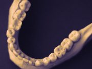 Jaw Osteonecrosis Tied to Treatment for Bone Metastases