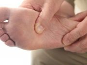 Deprivation Tied to Foot Disease With New Type 2 Diabetes