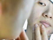 AAO-HNS Issues Guidance for Bell’s Palsy Treatment During COVID-19 AAO-HNS Issues Guidance for Bell's Palsy Treatment During COVID-19