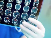 Prevalence of Vascular Risk Factors High for Hispanics/Latinos