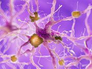 Donanemab Studied in Early Symptomatic Alzheimer Disease