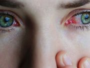 Incidence of Scleritis Down in the United Kingdom