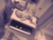 Birth Weight Modifies Link Between Adult IGF-1 Levels, T2DM