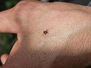 Mean Cumulative Incidence of Tick Bite ED Visits 49 Per 100,000