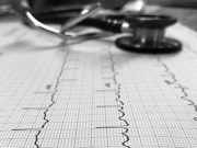 Athletes Have Higher Risk for Developing Atrial Fibrillation