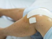 Abelacimab Prevents VTE After Total Knee Arthroplasty