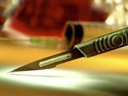 California to Pay Reparations to Victims of Forced Sterilization