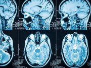 Patients Burdened by Cost of Diagnostic Imaging Interpretations