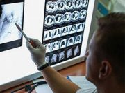 Lung Cancer Screening Rates Mainly Unchanged During Pandemic