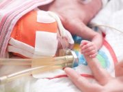 25 Weeks May Be Cutoff for Severe Neurological Outcomes in Preemies