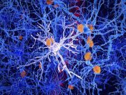 DPP-4i Use May Protect in Alzheimer Dementia With Diabetes