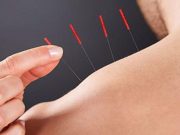 Acupuncture Alleviates Chronic Prostatitis, Pelvic Pain in Men