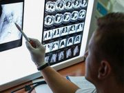 Guidance Issued for Low-Dose Chest CT Screening for Lung Cancer
