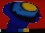 Neuroimaging Soon After Trauma May Predict Stress Response