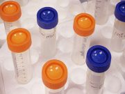 Vials Found in Lab Contained Vaccine, Not Smallpox Virus: CDC