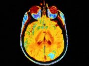 Young Veterans With Mild TBI Show Premature Cognitive Aging