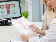 One-Third of Clinicians Still Offer Endometrial Scratching