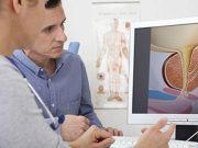 PSA Testing Rates Up in the U.S. After Change in Guidance