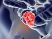 Young Have Greatest Burden of Distant Colorectal Adenocarcinoma