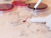 Polygenic Score Helps Guide Choice of Chemo for Pediatric AML