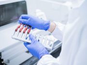 Blood Biomarkers May Help ID Primary CNS Lymphoma, High-Grade Glioma