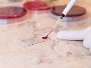 Non-O Blood Type Time-Dependent Predictor of VTE in Cancer