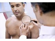 Primary Care-Based Screening Ups Thin Melanoma Detection