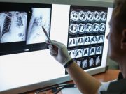 Coronary Heart Disease Risk Higher With COPD Carrying out a description of the radiographs of a patient with COPD