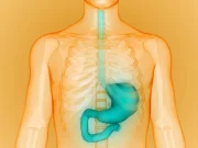 Survival Similar for Early, Delayed Surgery in Stage I Esophageal Cancer Hay un gran aumento en los cánceres de esófago entre los estadounidenses de mediana edad
