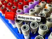 Monkeypox Poses Challenges, Even in High-Income Countries For Spanish Translation
