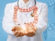 ASCO: ctDNA Analysis Guides Treatment of Stage II Colon Cancer