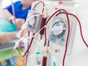 Mortality Increased for Dialysis Patients With Hurricane Exposure