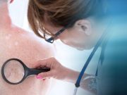 AI System Could Help Clinicians Assess Psoriasis Severity