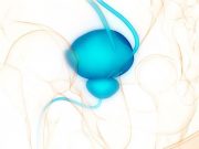 PSA Screening Tied to Lower Risk for Prostate Cancer Mortality