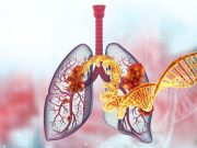 Pathogenic Germline Variants ID’d in Patients With Lung Cancer