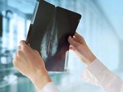 Response to Neoadjuvant Endocrine Therapy for Breast Cancer May Vary by Race