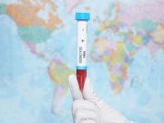 Major Trial of Monkeypox Treatment TPOXX to Launch in Africa