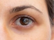 Use of Anesthesia Care for Cataract Surgery Examined