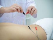 Electroacupuncture Cuts Risk for Prolonged Postoperative Ileus