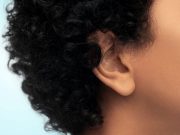 Sequencing IDs Genetic Diagnoses for Sensorineural Hearing Loss