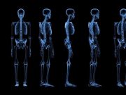 Bone Scintigraphy Can Help ID Cardiac Amyloidosis