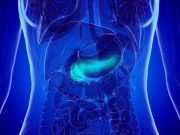 Incidence of Pancreatic Cancer Increasing in Younger Women