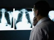 Lung Cancer Screening Based on Personal Risk Is Cost-Effective