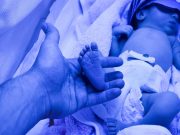 Preterm Birth, Low Birth Weight Linked to Lower Incidence of Fracture