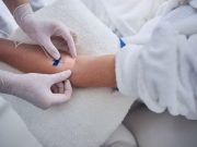 Hydrocortisone Does Not Reduce 90-Day Mortality in Septic Shock