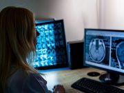 MRI May Be Preferred to CT With CT Angiography Alone for Dizziness in ED