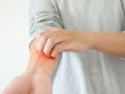 Higher Risk for Schizophrenia Seen Among Patients With Eczema