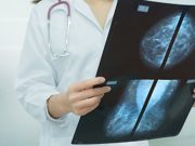 Diagnostic Performance of AI Comparable to Humans for Mammograms
